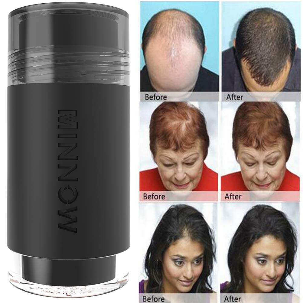 MINNOW Hair Building Fibers,Keratin Hair Fibers Hair Loss Concealer For Thinning Hair Powder Volumizing Based,16grams/0.56oz (MEDIUM BROWN)