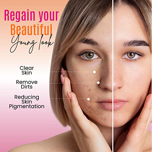 DERMAXGEN Organic Kojic acid & Vitamin C Soap Bar | Arbutin, Glutathione | Advanced Glowing formula, Replenish, & Radiant Skin | Pure Natural Pigmentation For Face & Body - 5 OZ Each (Pack 1)