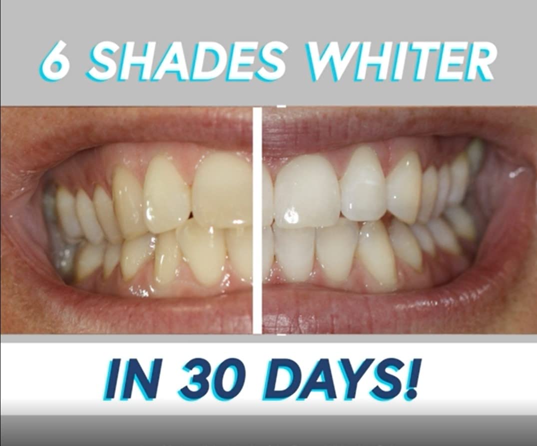 Smileactives Advanced Teeth Whitening Pen- with Tooth Whitening Gel for White Teeth, Vanilla Mint Duo Pack + Winterberry Duo Pack - Travel Size 0.11 Ounce Each