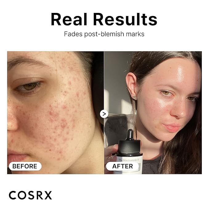 COSRX 15% Niacinamide Face Serum, 0.67 fl oz, Pore Minimizer Serum for Face, Even Skin Tone, Korean Skin Care