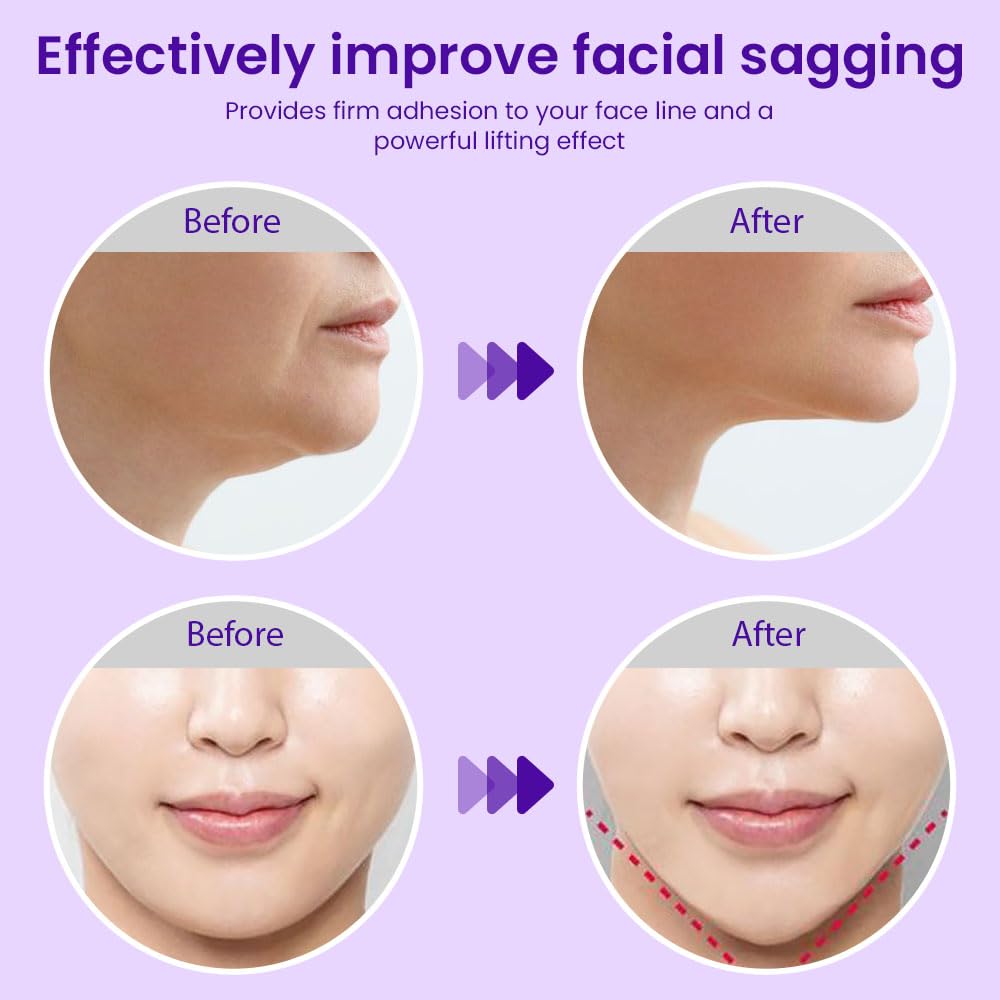 evpct 6Pcs V Line Lifting Hydrogel Collagen Mask Strap with Aloe Vera and Seaweed, Hydrating and Anti-aging
