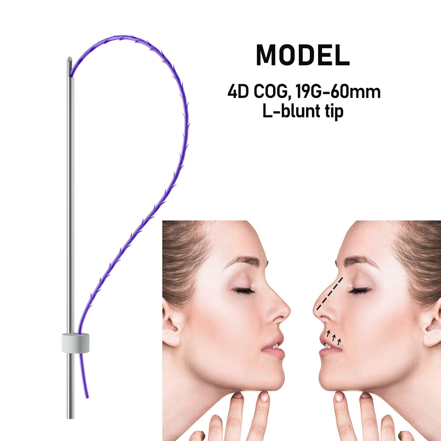 Elves PDO Nose Thread Lift/Nasal 4d COG Pdo Threads for Nose Columella Nose Bridge Nose Dorsum Lift/L-Blunt Type, 20PCS (19G 60mm)
