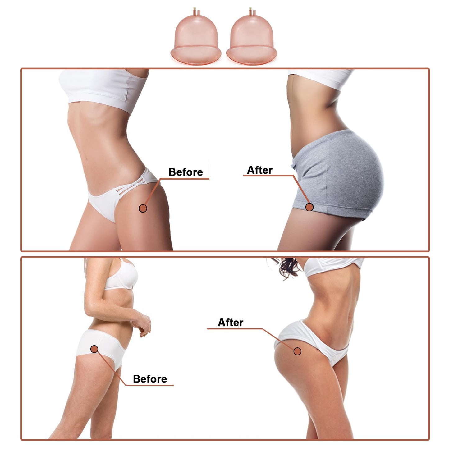 Elitzia Vacuum Cups for Butt Lifting 3000ML/101Fl.oz Vacuum Cupping Machine Accessories Extra-Large Buttocks 9.05inch bottom diameter 6.69inch height 1 Pair ETHX005 (Peach)