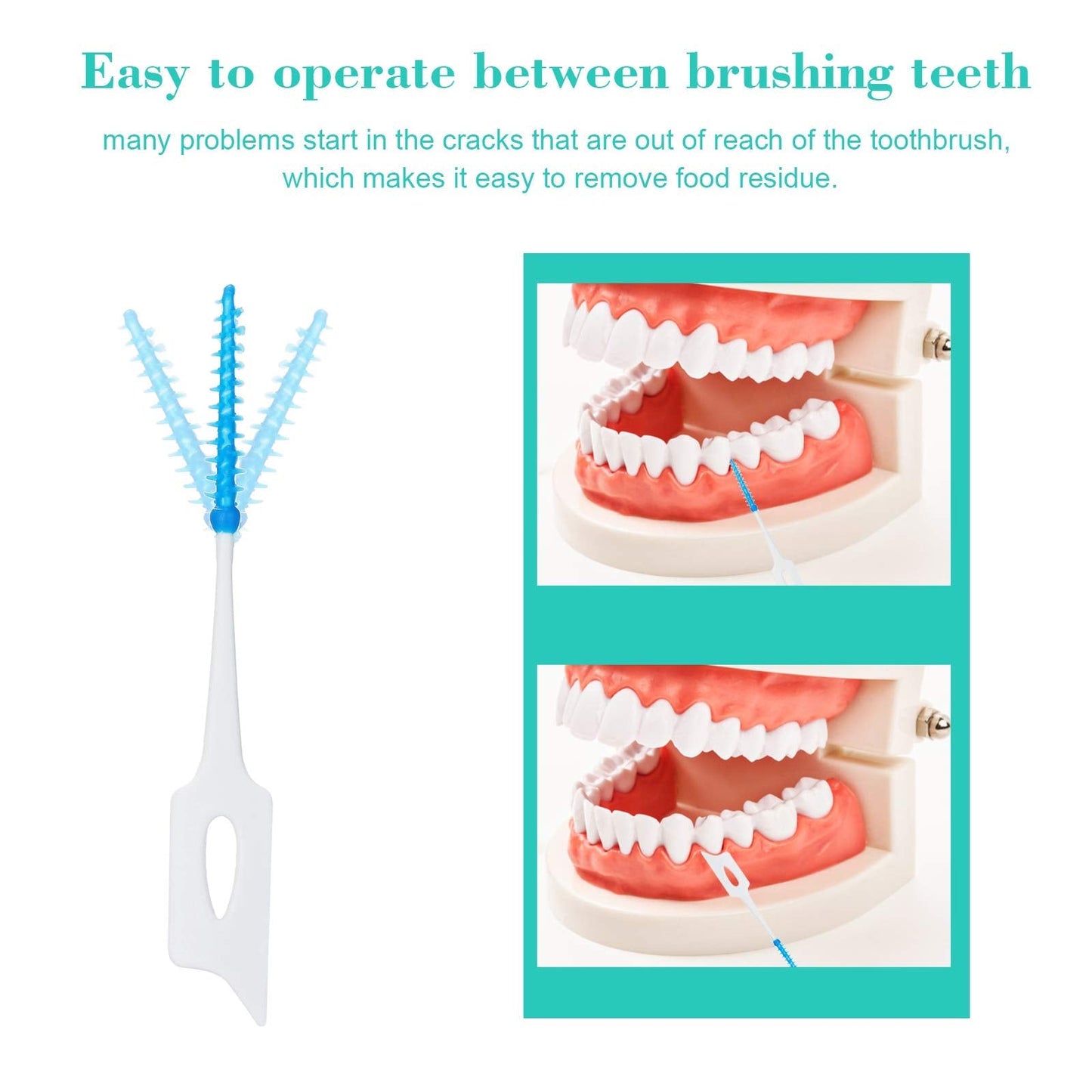 Layhou 160PCS Interdental Brushes Dental Picks for Teeth Ultra Tight Bristles Tooth Interdental Cleaners Silicone Toothpick Brush Cleaners Disposable Brushes Teeth Soft Toothpick