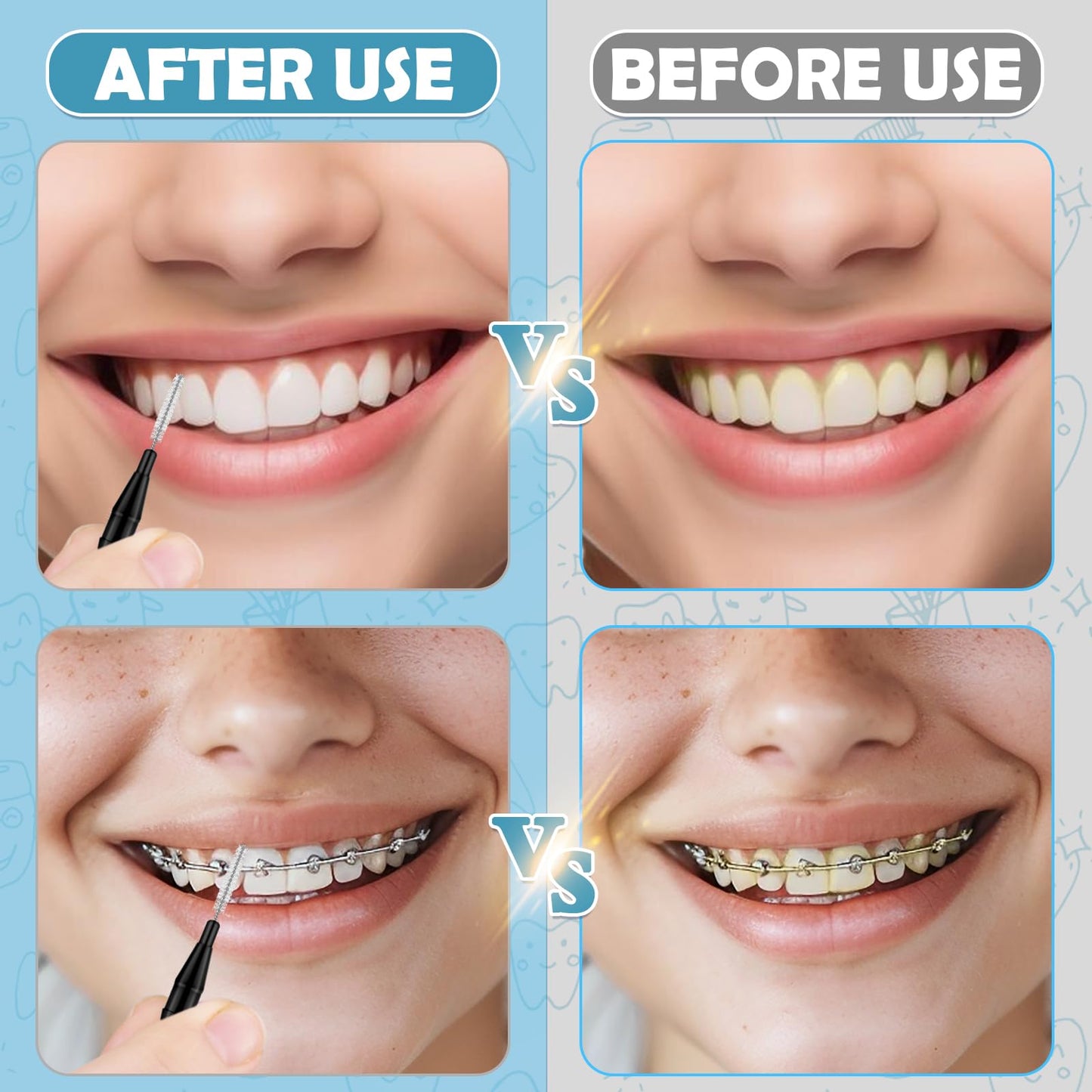MAPVOLUT 120 Pieces Braces Flossers for Cleaner Interdental Brushes Between Teeth, Toothpick Dental Tooth Flossing with Soft Bristles 360° Bendable Oral Dental Hygiene Flosser Cleaning Tool