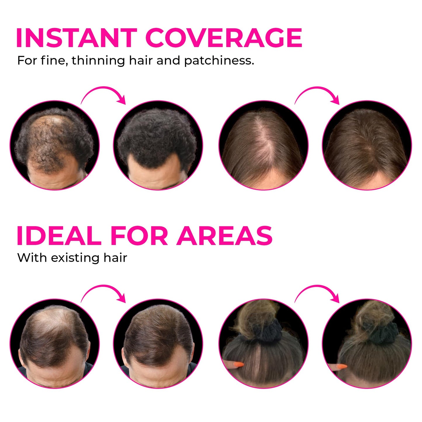 VELO Hair Building Fibers for Thinning Hair, 30g Fill in Fine, Instantly Thicker & Fuller Look, Hair Thickening Fiber, Conceals Hair Loss, Hair Powder for Women & Men, Long Lasting Formula (WHITE)