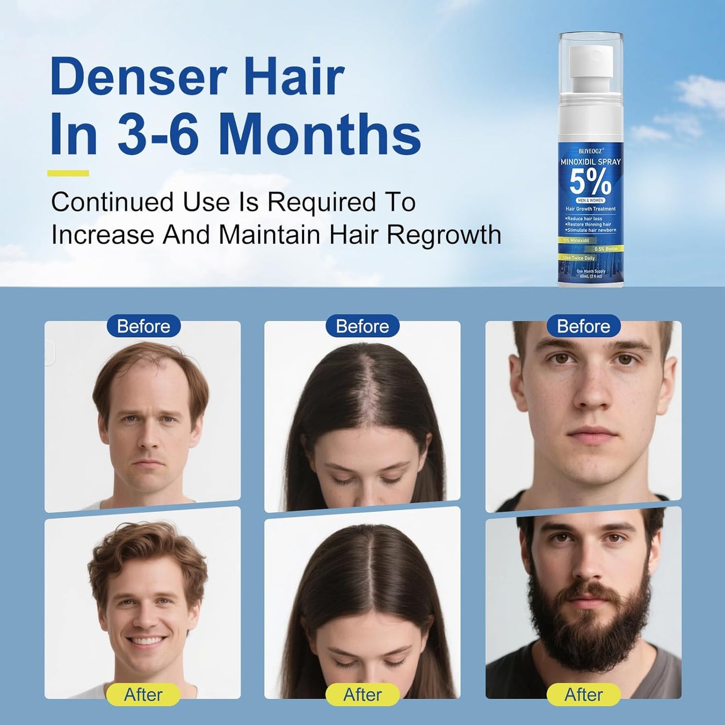5% Minoxidil Spray for Men and Women, Infused with Biotin, for Hair Regrowth Treatment, Beard Growth, Extra Strength Treatment to Combat Hair Loss and Thinning, 3 Month Supply, 3 Bottles