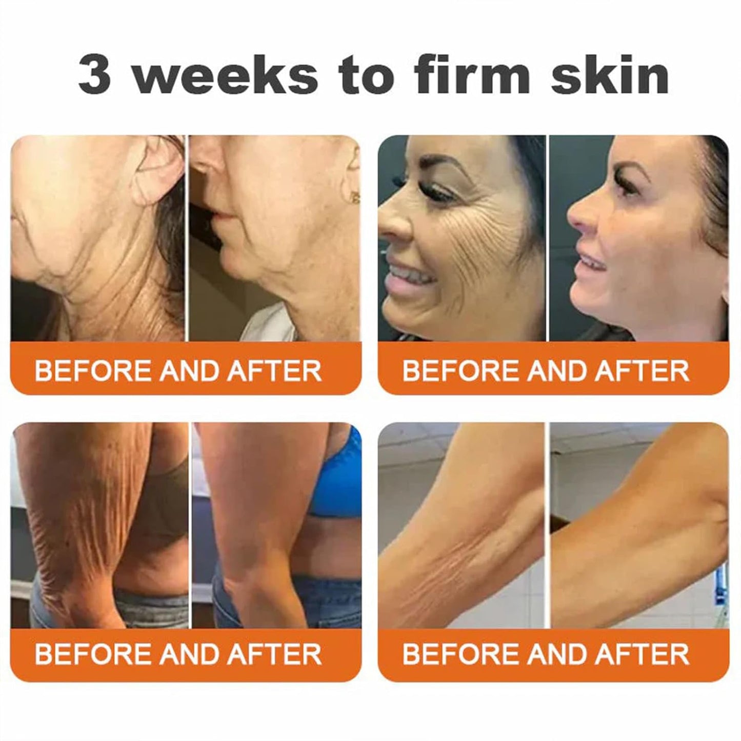 Bee Venom Comprehensive Cream, Professional bee venom cream for Removing and Repair, APKAPK Bee Venom Skin Treatment Cream, Natural Serum Suitable for All Skin Types (4 Pack)