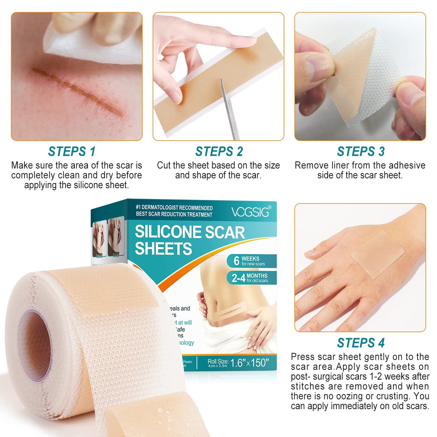 Generic Silicone Scar Sheets,Silicone Scar Tape Roll for Scar Removal(1.6”x150”-3.8M),Reusable Waterproof Professional Soft Silicone Tape, Yellow