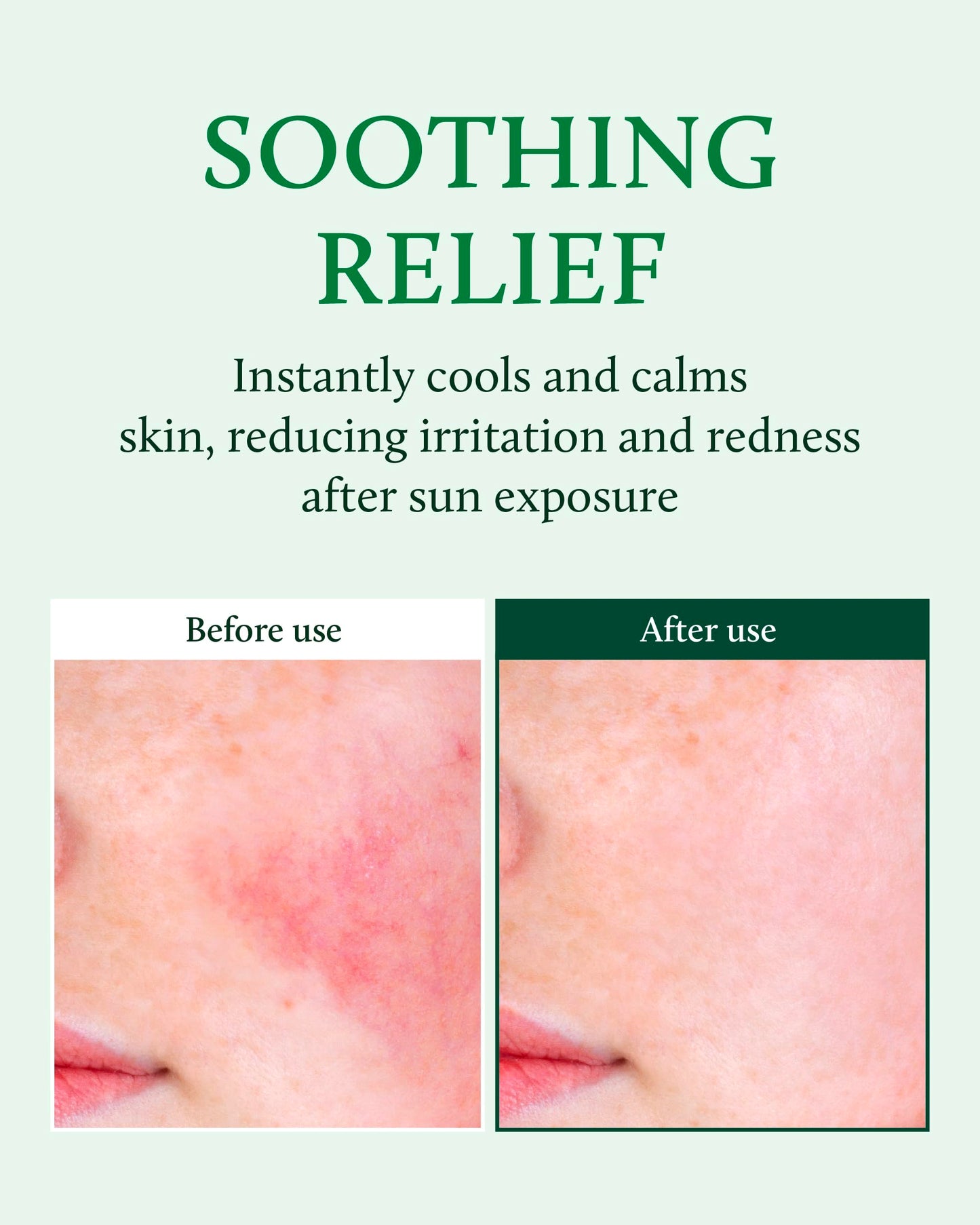 YADAH Cactus Soothing Gel (8.45fl oz) - Sunburn Relief, Calm, Cool & Soothe Irritated Skin, Face Redness. Korean Skin Care. 95% Cactus Extract, Vegan.