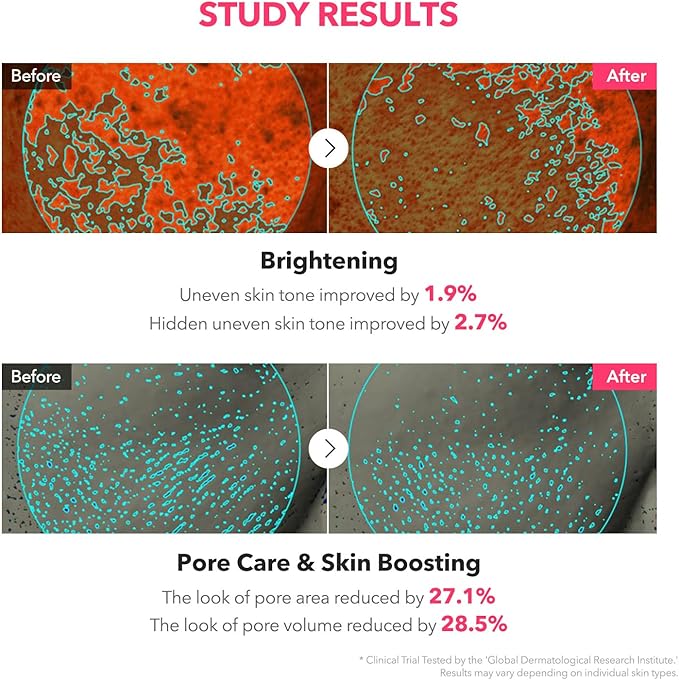 APRILSKIN TXA Niacinamide Toning Shot 99 Spicule Facial Serum｜Skin Booster Serum for Brightening and Pore Care｜99% High-Purity Tranexamic Acid 3% + Niacinamide 5%｜Korean Skin Care｜1.01 fl. oz.