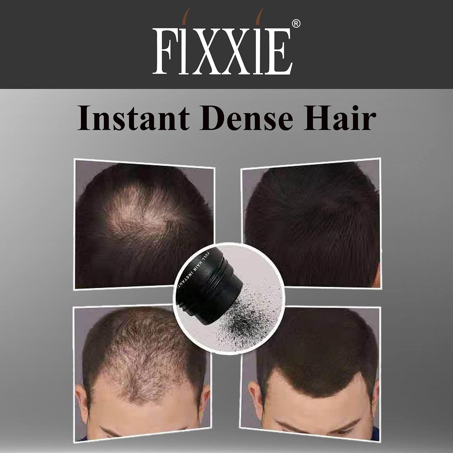 FIXXIE Hair Fibers MEDIUM BROWN for Thinning Hair 27.5g Bottle, Hair Fibre Concealer for Hair Loss for Men and Women, Naturally Thicker Looking Hair with Keratin Hair Fibres