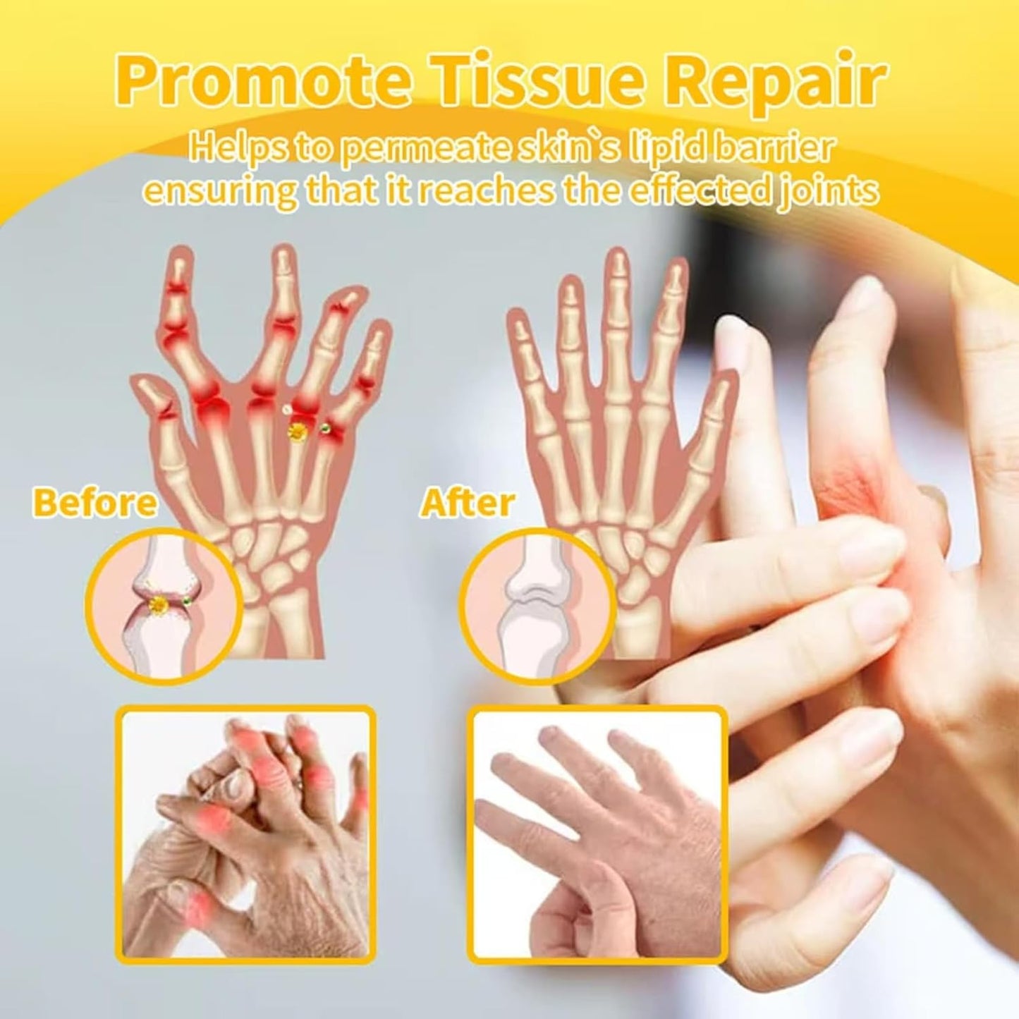 Botulinum Toxin & Bee Venom Pain-Relief Bone Healing Cream, 2025 New Bee Venom Cream for Arthritis, Bee Venom Joint Therapy Pain Relief Gel for Back, Knee, Hands, Neck, Feet, for All Skin Types(2PCS)