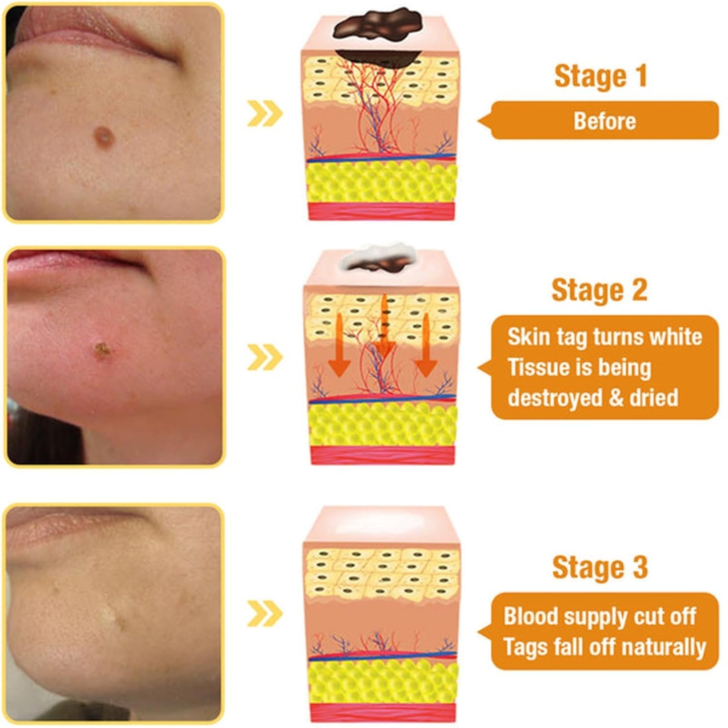 Bee Venom Comprehensive Cream, 2025 New Bee Venom Skin Treatment Cream, Firms and rejuvenates the skin, Natural Serum Suitable for All Skin Types (1)