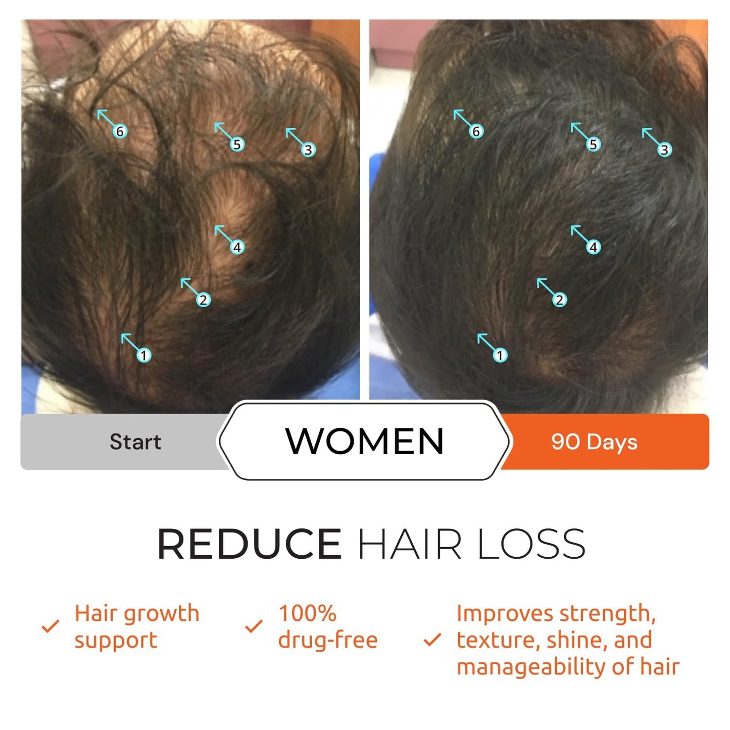 Revita Shampoo and Revita Tablets to Support Hair Growth Bundle, Packaging May Vary
