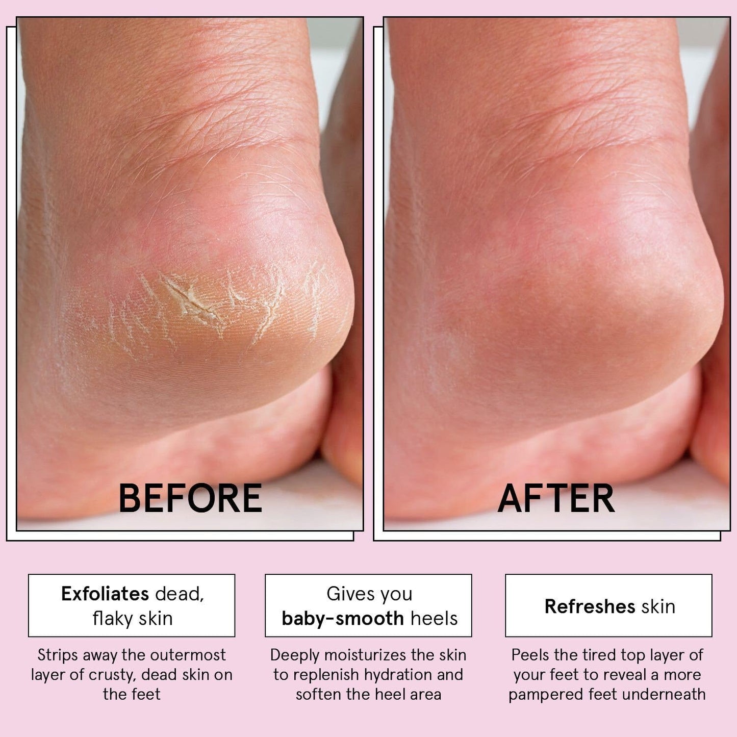 grace & stella Award-Winning Foot Peel Mask - Foot Peeling Mask with Aloe Vera - Moisturizing Foot Mask for Dry Cracked Feet - Foot Exfoliator for Baby Soft Feet (2 Pairs, Lavender)