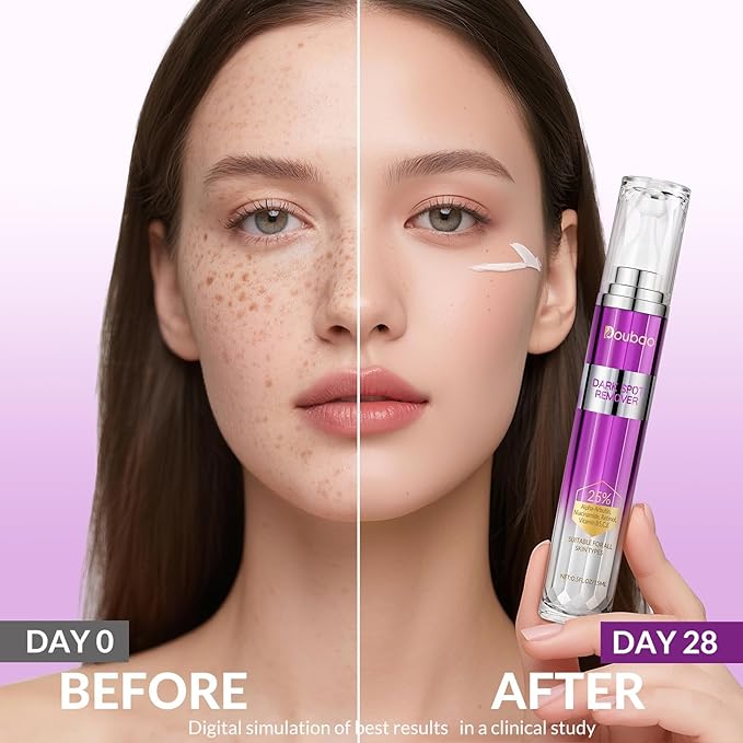 Dark Spot Remover for Face and Body, Dark Spot Corrector for Melasma, Sun Spots, Age Spots and Acne Scars, Correcting Glow Serum with Retinol and Licorice Extract, 0.5 fl oz