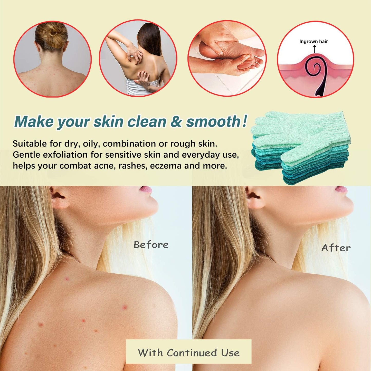 MIG4U Shower Exfoliating Scrub Gloves Medium to Heavy Bathing Gloves Body Wash Dead Skin Removal Deep Cleansing Sponge Loofah for Women and Men 5 Pairs 5 Colors