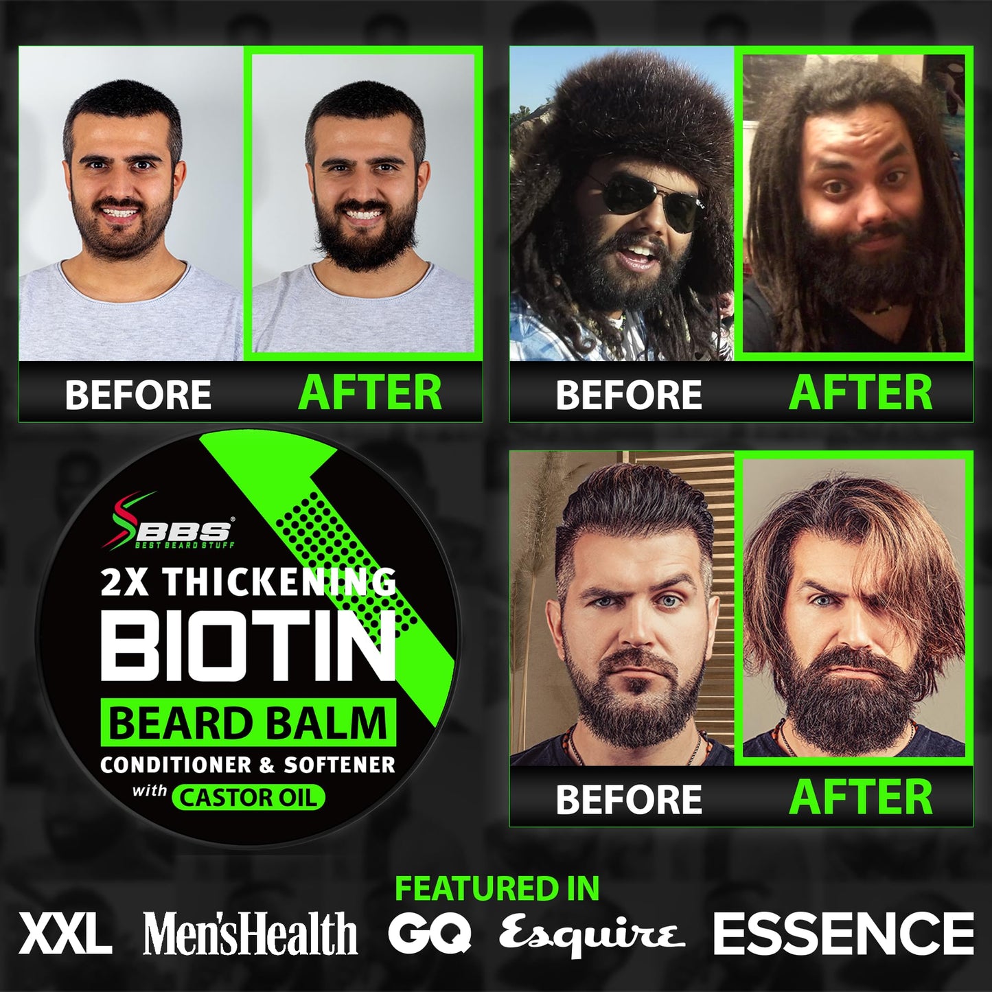 Beard Growth Kit w/ 2X Biotin Beard Balm for Men + GROW Hair & Beard Shampoo (11-in-1 Biotin Shampoo for Men) + GROW Beard Growth Oil for Men BBS USA