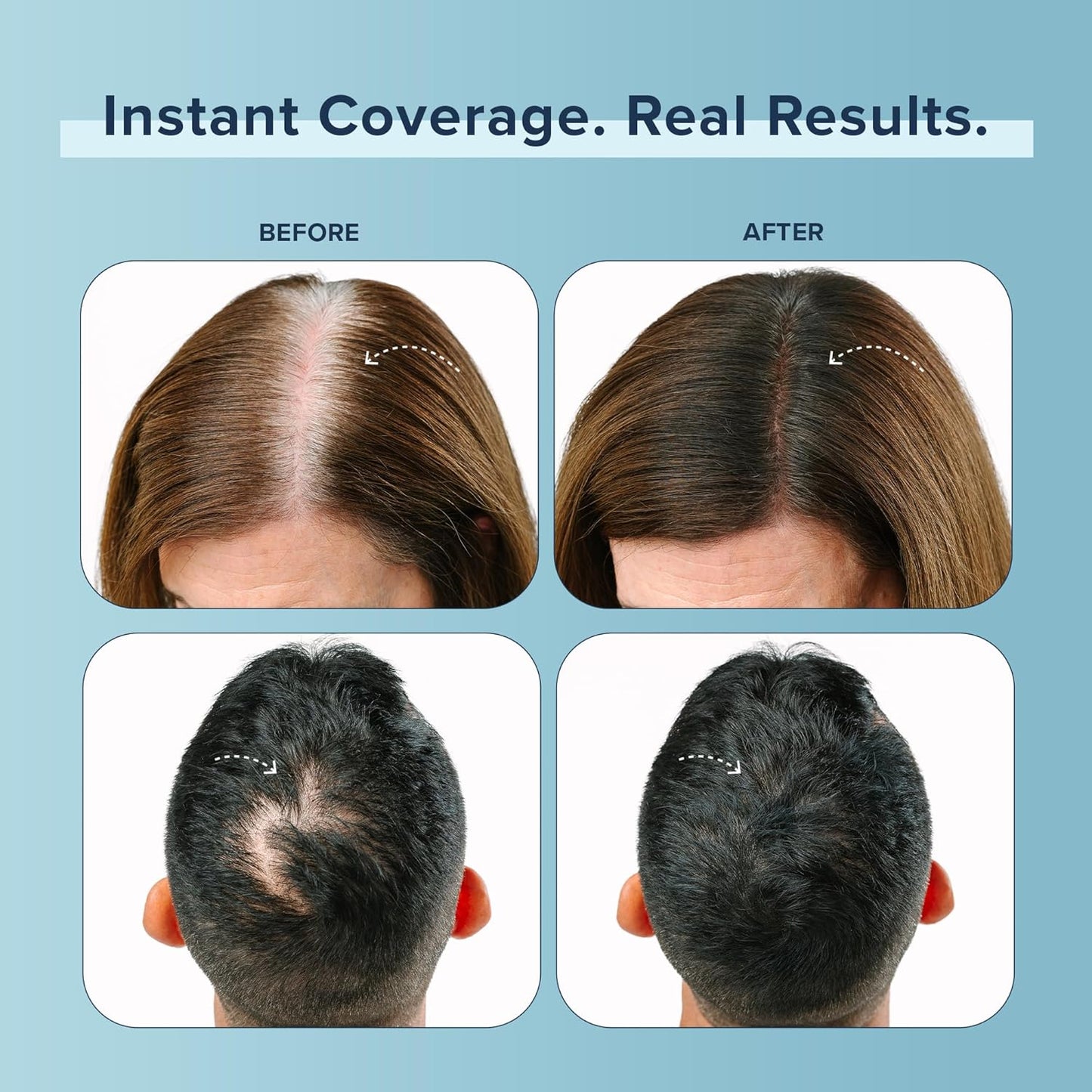 TRUHAIR Color Fibers Root Coverage & Density Booster | Quick-Apply Root Touch Up Hair Color | Natural Color Matching, Gray Hair Cover up to Color Gray Roots - 11 Hair Colors Available (Medium Brown)